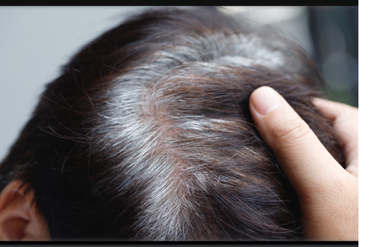 Understanding Gray Hair: Causes, Prevention, and Solutions